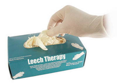 Hirudotherapy Gloves